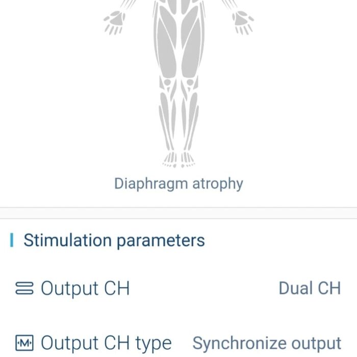 MSTIM-RH-8.jpg